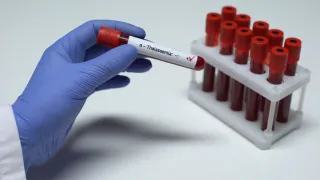 Carenza medici in Ematologia a Crotone: protestano i pazienti