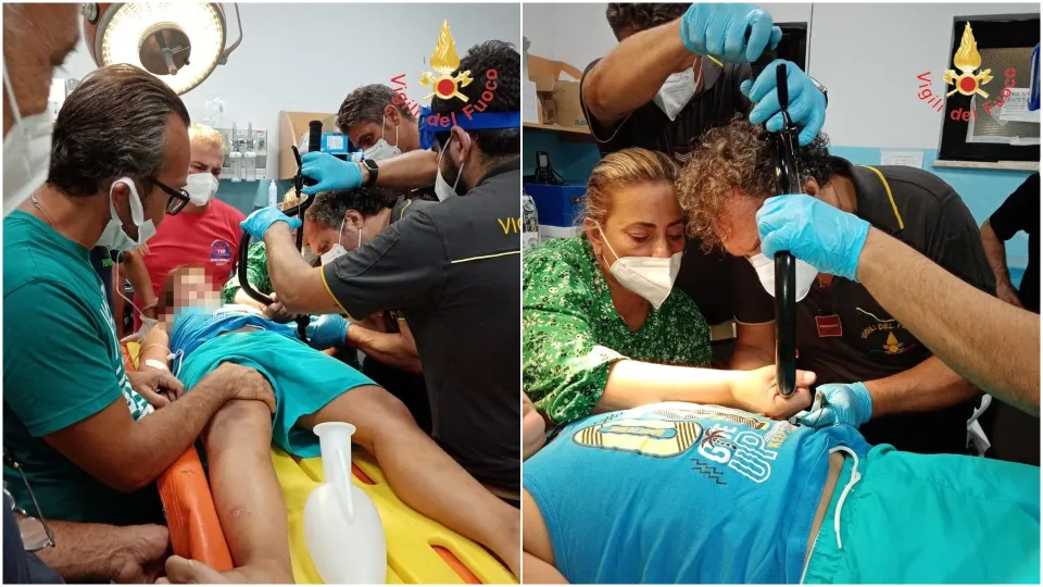 Cade dalla bici, ma rimane infilzato con il manubrio ed il freno: bimbo salvato a Crotone