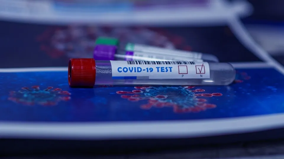 Coronavirus, in Italia 7.224 nuovi contagi: il bollettino di Ministero della Salute ed ISS del 20 agosto