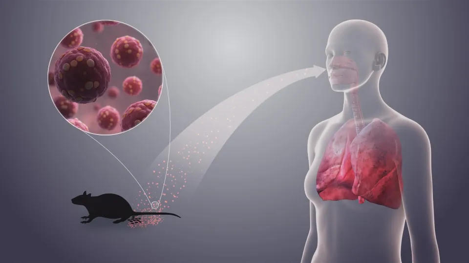 Hantavirus, passeggero calabrese sotto sorveglianza sanitaria